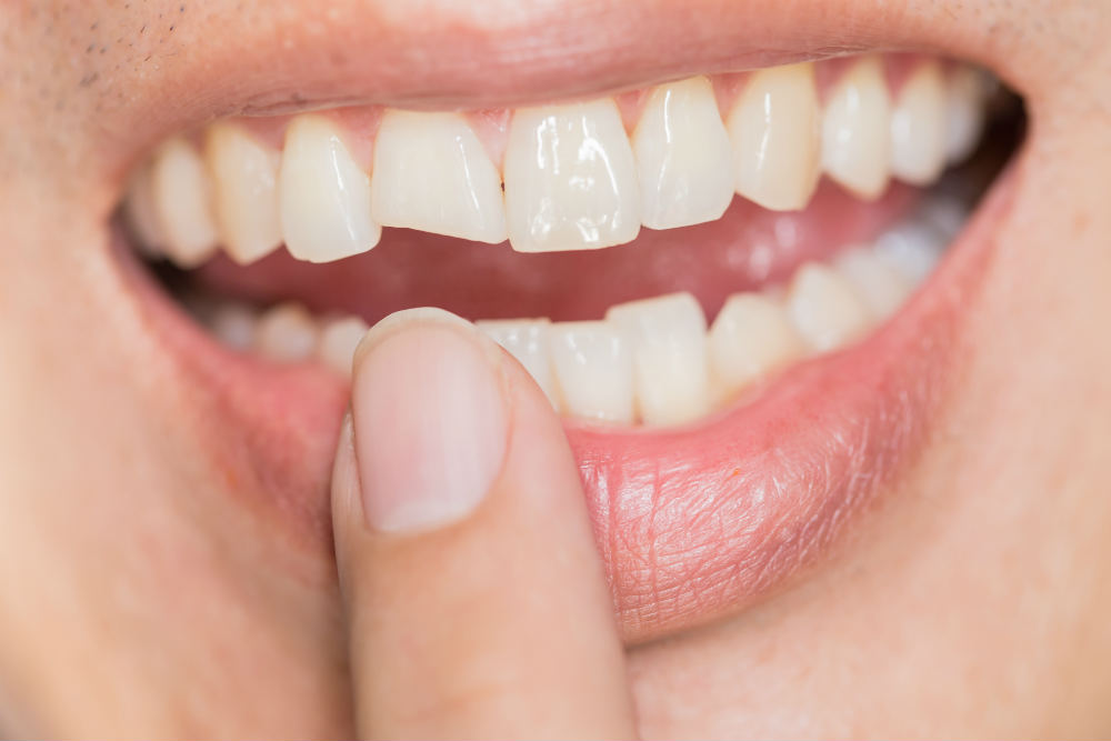 Как спасти гнилые зубы?