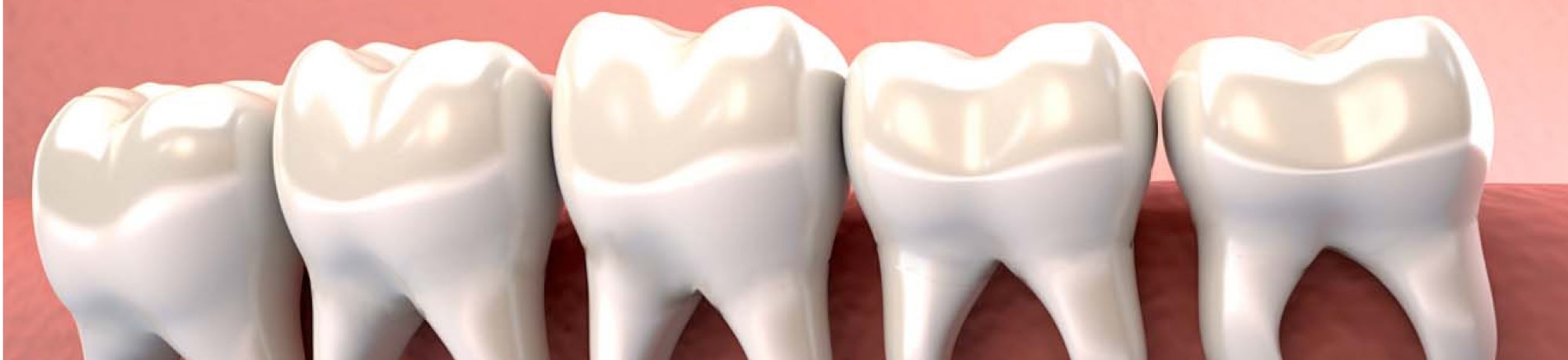 Болит зуб мудрости: причины и лечение
