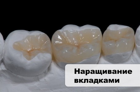 4 Зуб Фото